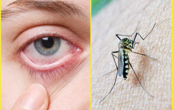 देशात घोंघावतंय झिका व्हायरसचं संकट