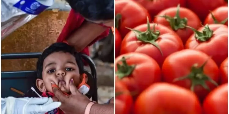 सावधान! टोमॅटो तापाने उडवली झोप; लहान लेकरांची घ्या काळजी, कोणतीही लस उपलब्ध नसल्याने धास्ती
