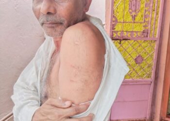 माथेरानमध्ये पिसाळलेल्या कुत्र्याची दहशत