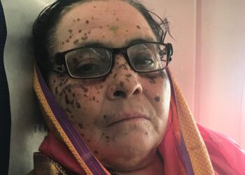 राजकोर ठाकरे यांचे निधन