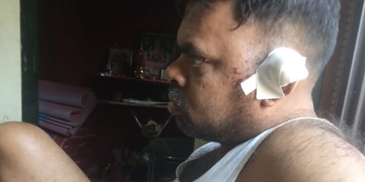 बिबट्याच्या हल्लात गंभीर जखमी