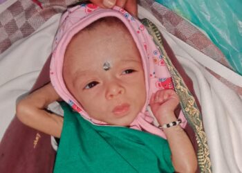 कर्जत तालुक्यातील कुपोषणात होतेय घट