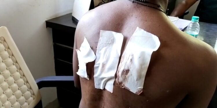 धक्कादायक! पूर्ववैमनस्यातून तिघांवर चाकूहल्ला