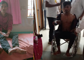 जिल्हा रुग्णालयातील स्लॅप कोसळला; दोघे जखमी