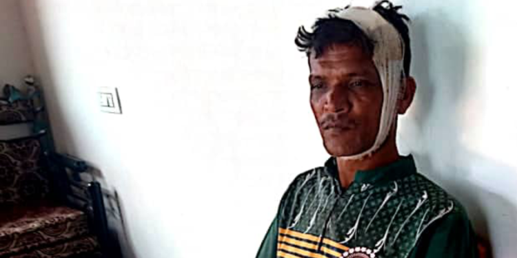 नगरपरिषद कंत्राटी कामगार गंभीर जखमी