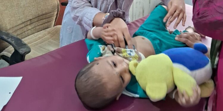 कुपोषित बालकांची तपासणी