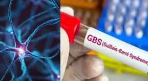 मुंबईत जीबीएसचा पहिला रुग्ण आढळला