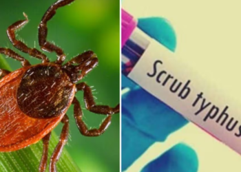जिल्ह्यात स्क्रब टायफसचा पहिला रुग्ण