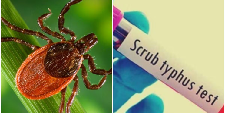 जिल्ह्यात स्क्रब टायफसचा पहिला रुग्ण