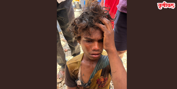 मोबाईल हिसकावण्यासाठी महिलेला चावा
